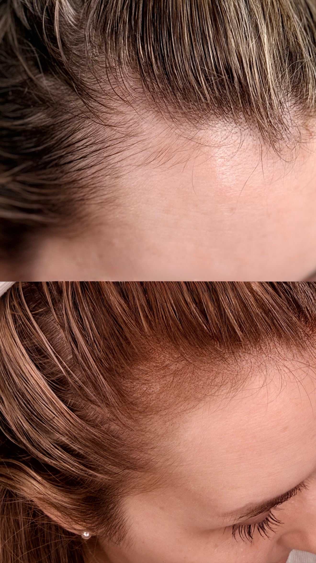 VTCT Skills (ITEC) Level 4 Award in Scalp Micropigmentation Treatment