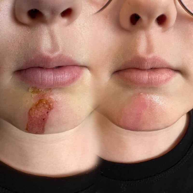 NYSE Healing Balm – Post Lip Blush Recovery